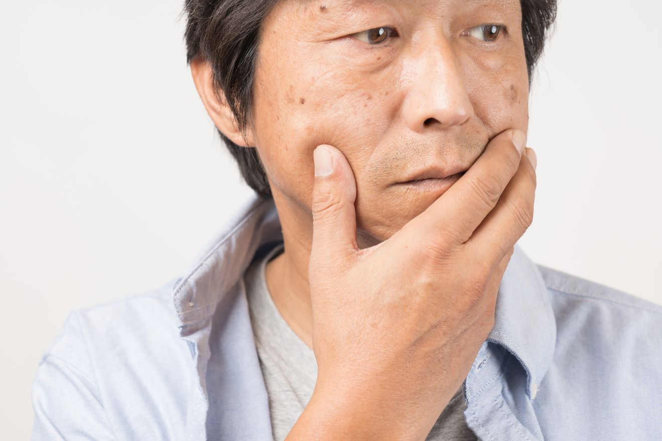 How to Get Rid of Age Spots for Men